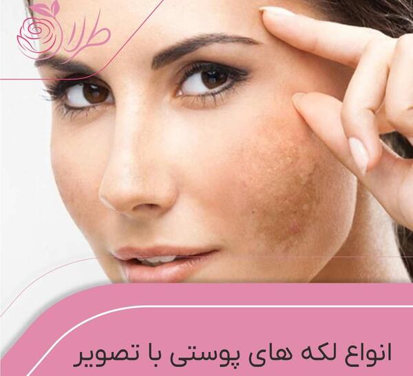 عکس قبل و بعد لک صورت