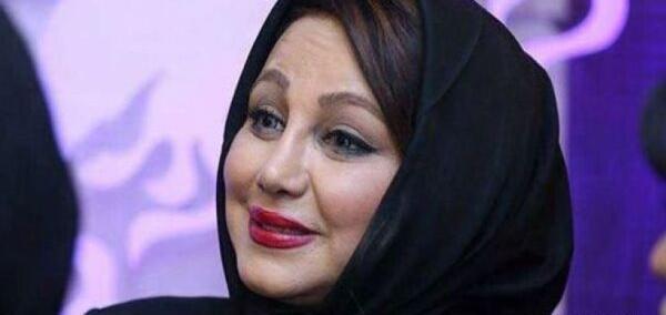 عکس صبا راد قبل از عمل بینی