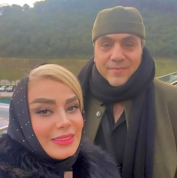 عکس صبا راد قبل از عمل بینی