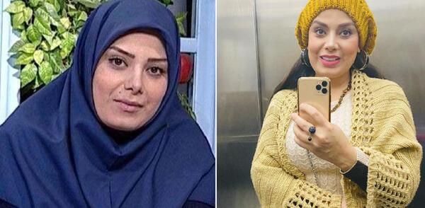 عکس صبا راد قبل از عمل بینی