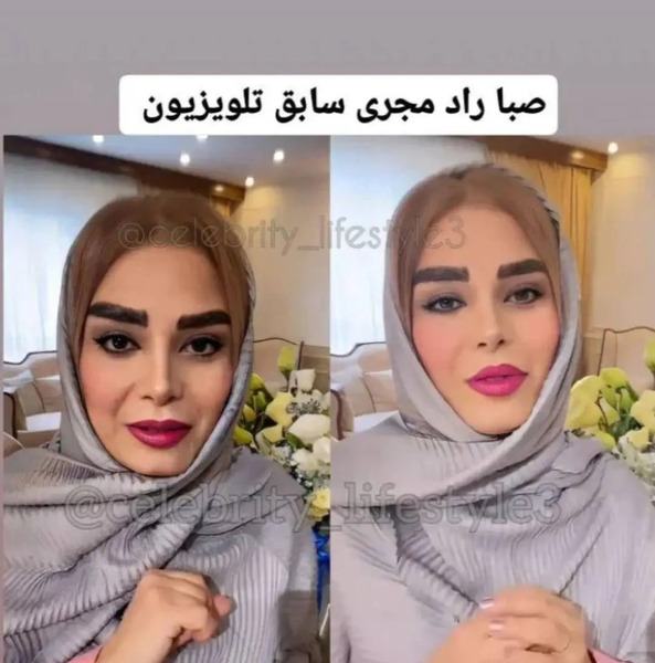 عکس صبا راد قبل از عمل بینی