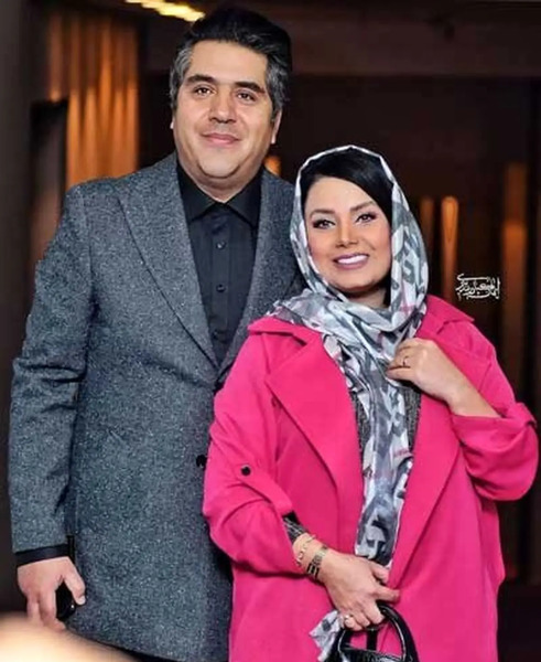 عکس صبا راد قبل از عمل بینی