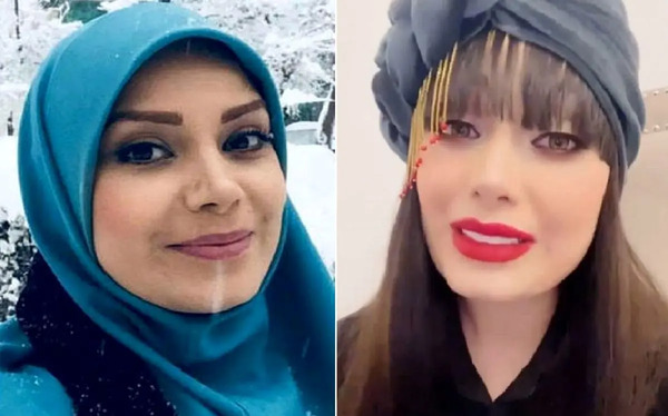 عکس های قبل از عمل صبا راد