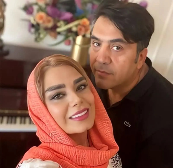 عکس های قبل از عمل صبا راد