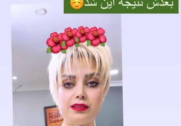عکس های قبل از عمل صبا راد