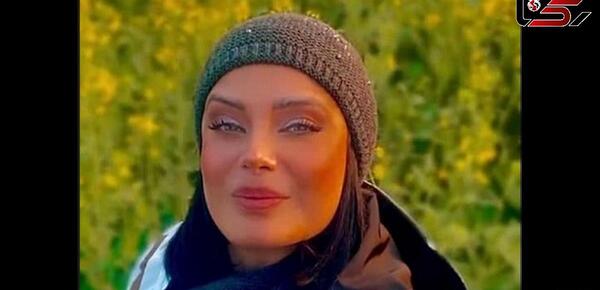 عکس های قبل از عمل صبا راد