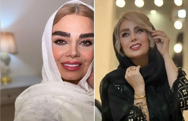 عکس های قبل از عمل صبا راد