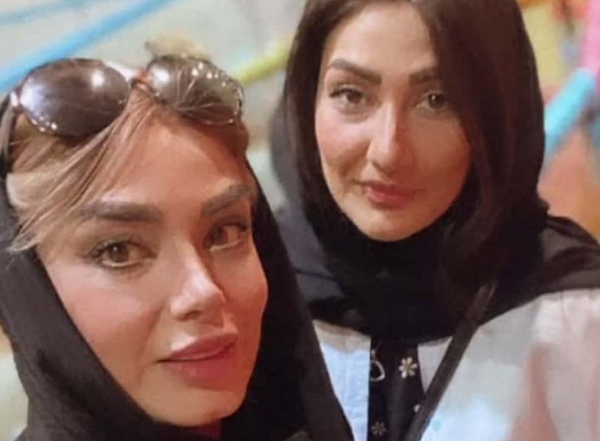 بینی عکس صبا راد قبل از عمل زیبایی