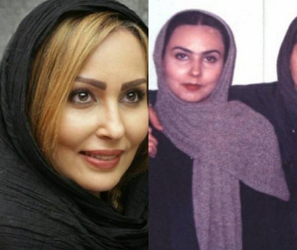 بینی عکس صبا راد قبل از عمل زیبایی