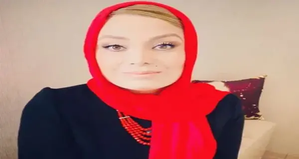 بینی عکس صبا راد قبل از عمل زیبایی