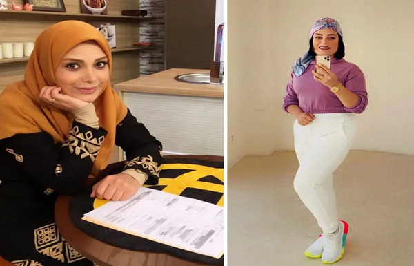 بینی عکس صبا راد قبل از عمل زیبایی