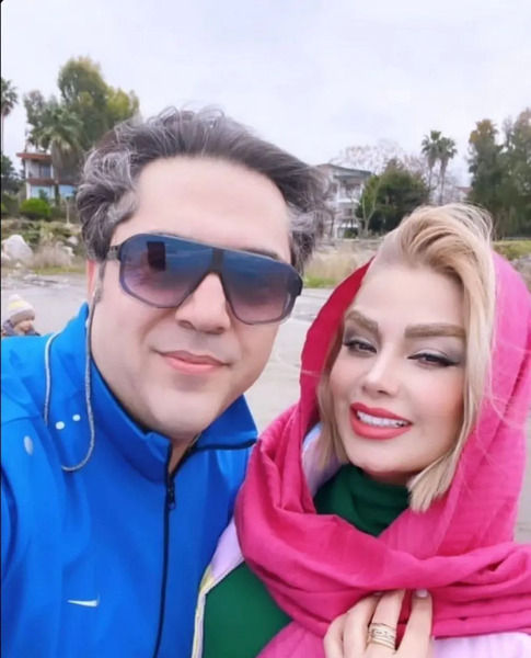 بینی عکس صبا راد قبل از عمل زیبایی