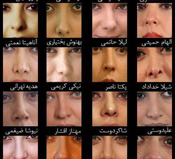 عکس های قبل عمل شیلا خداداد