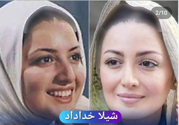 عکس های قبل عمل شیلا خداداد