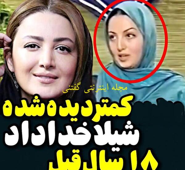 عکس های قبل عمل شیلا خداداد
