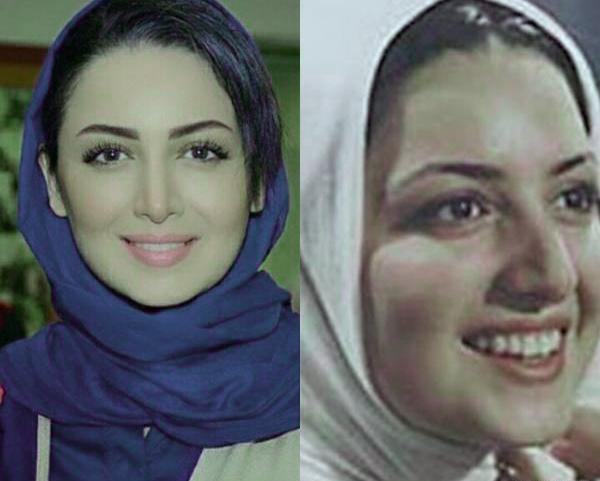 عکس های قبل عمل شیلا خداداد