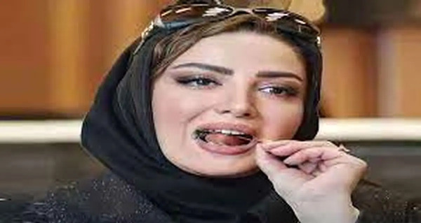عکس قبل و بعد عمل شیلا خداداد