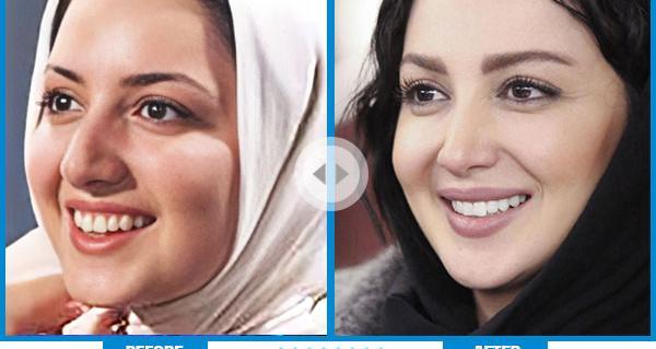 عکس قبل و بعد عمل شیلا خداداد