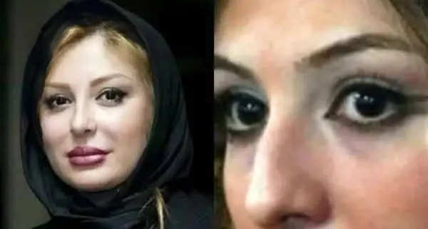عکس قبل و بعد عمل شیلا خداداد