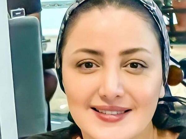 عکس قبل و بعد عمل شیلا خداداد