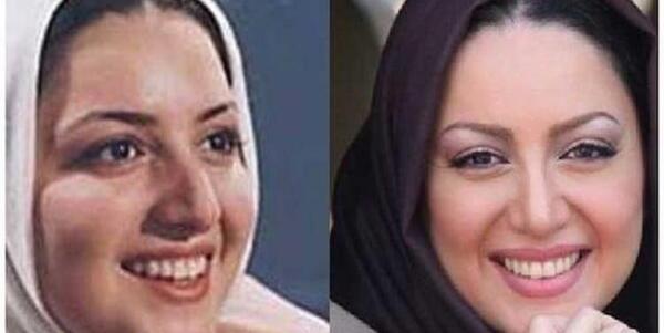 عکس قبل و بعد عمل شیلا خداداد
