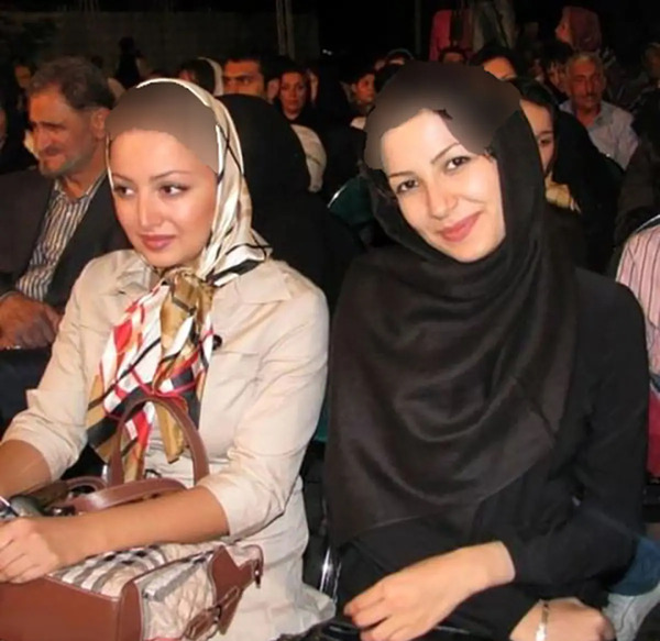 عکس قبل و بعد عمل شیلا خداداد