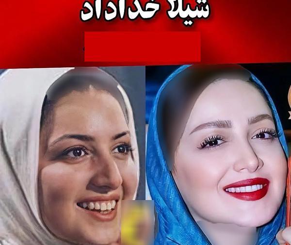 عکس قبل و بعد عمل شیلا خداداد