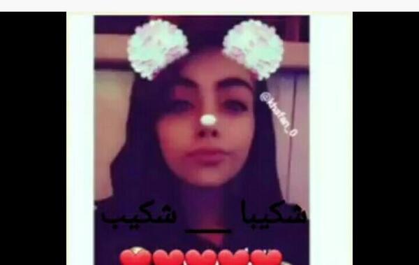 عکس قبل و بعد شکیب غلامی