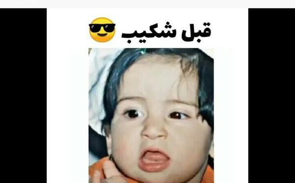 عکس قبل و بعد شکیب غلامی