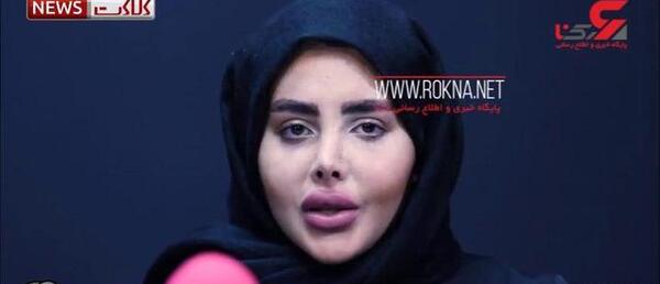عکسهای سحر تبر قبل و بعد از عمل