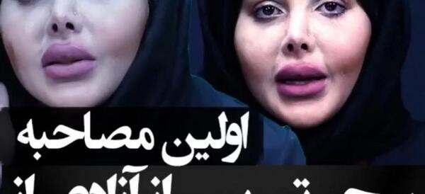 عکسهای سحر تبر قبل و بعد از عمل