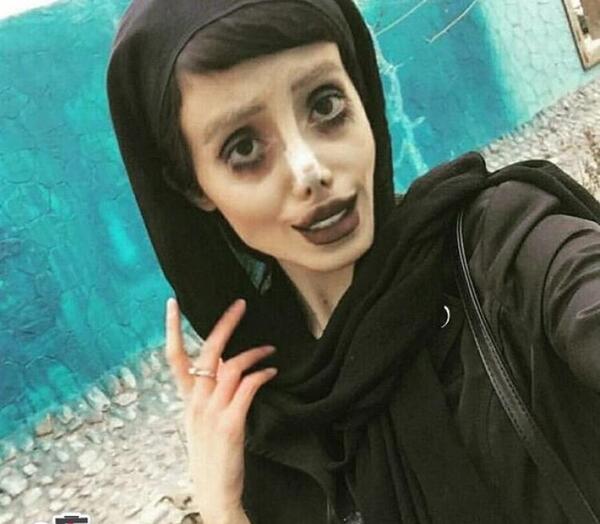 عکسهای سحر تبر قبل و بعد از عمل