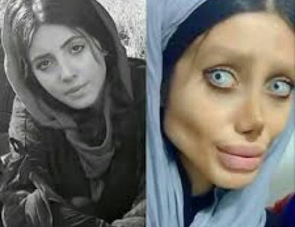 عکسهای سحر تبر قبل و بعد از عمل