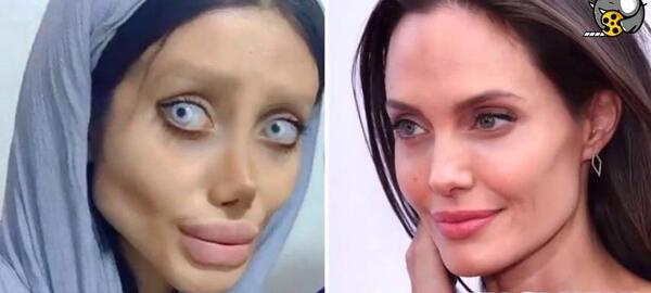 عکسهای سحر تبر قبل و بعد از عمل