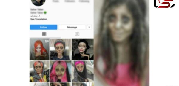 عکسهای سحر تبر قبل و بعد از عمل