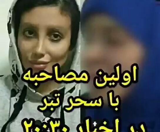 عکسهای سحر تبر قبل و بعد از عمل