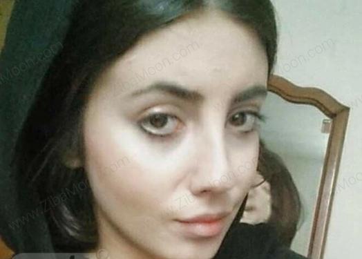 عکسهای سحر تبر قبل و بعد از عمل