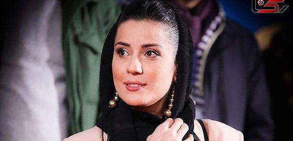 عکس سیروان خسروی قبل از عمل بینی