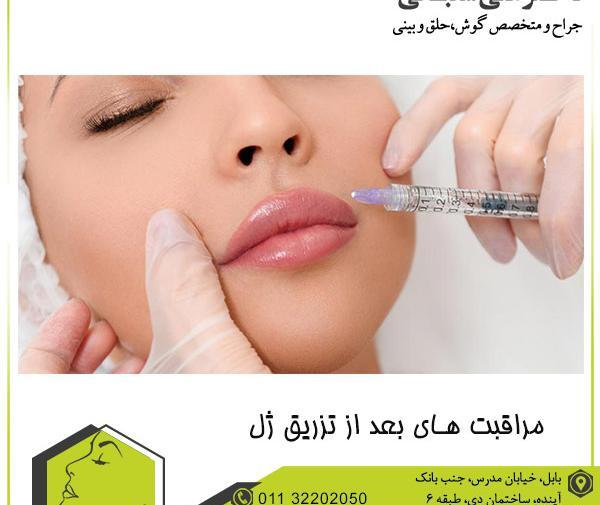 عکس های قبل و بعد از تزریق ژل گونه