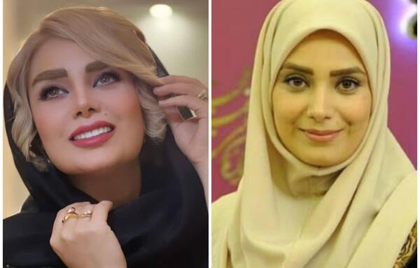 عکس های قبل از عمل ژیلا صادقی