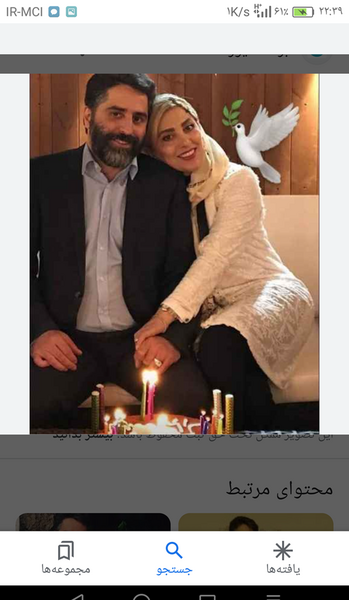 عکس قبل و بعد از عمل ژیلا صادقی