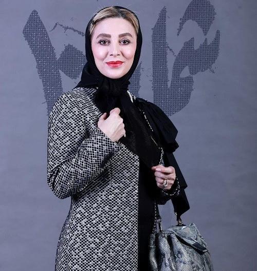 عکس قبل و بعد از عمل ژیلا صادقی