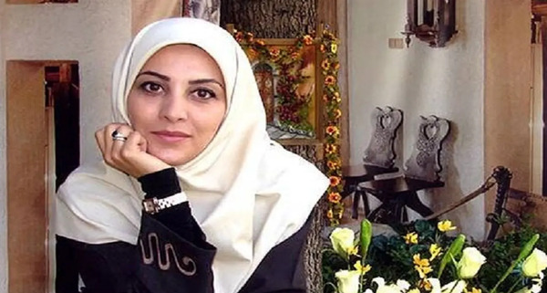 عکس قبل و بعد از عمل ژیلا صادقی