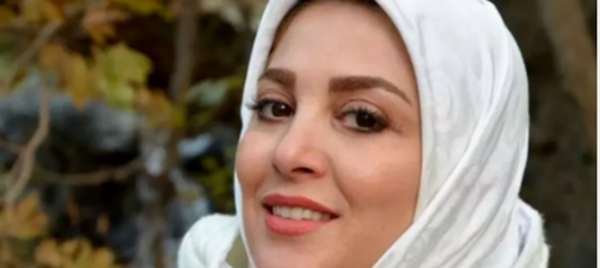 عکس قبل و بعد از عمل ژیلا صادقی