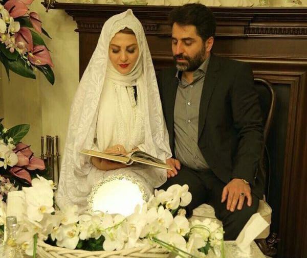 عکس قبل و بعد از عمل ژیلا صادقی