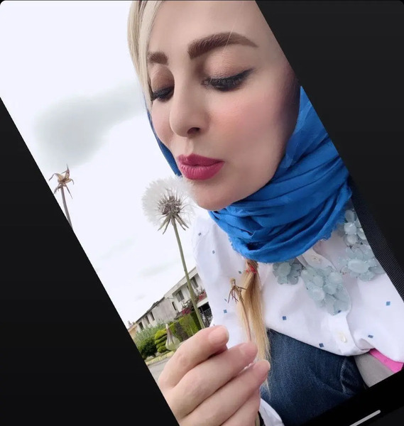عکس قبل و بعد از عمل ژیلا صادقی