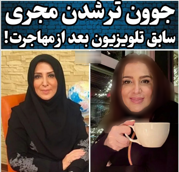 عکس ژیلا صادقی قبل از عمل زیبایی