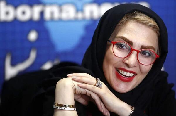 عکس ژیلا صادقی قبل از عمل زیبایی