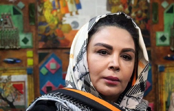 عکس ژیلا صادقی قبل از عمل زیبایی