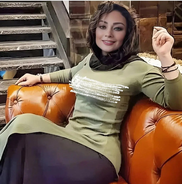 عکس قبل عمل یکتا ناصر